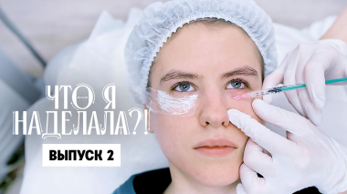 Что я наделала?! Коллаген: красота или слезы?